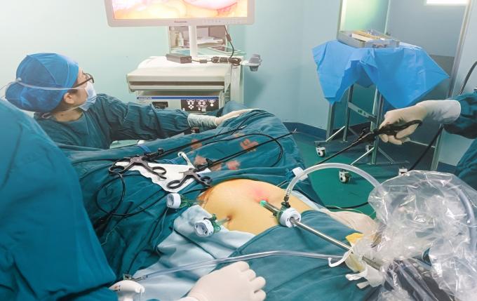 Steriele wegwerpoptische trocar en cannula voor laparoscopische chirurgie 6