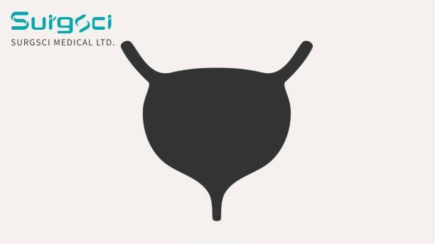 laatste bedrijfsnieuws over Klinische classificatie van blaastuberculose. 0